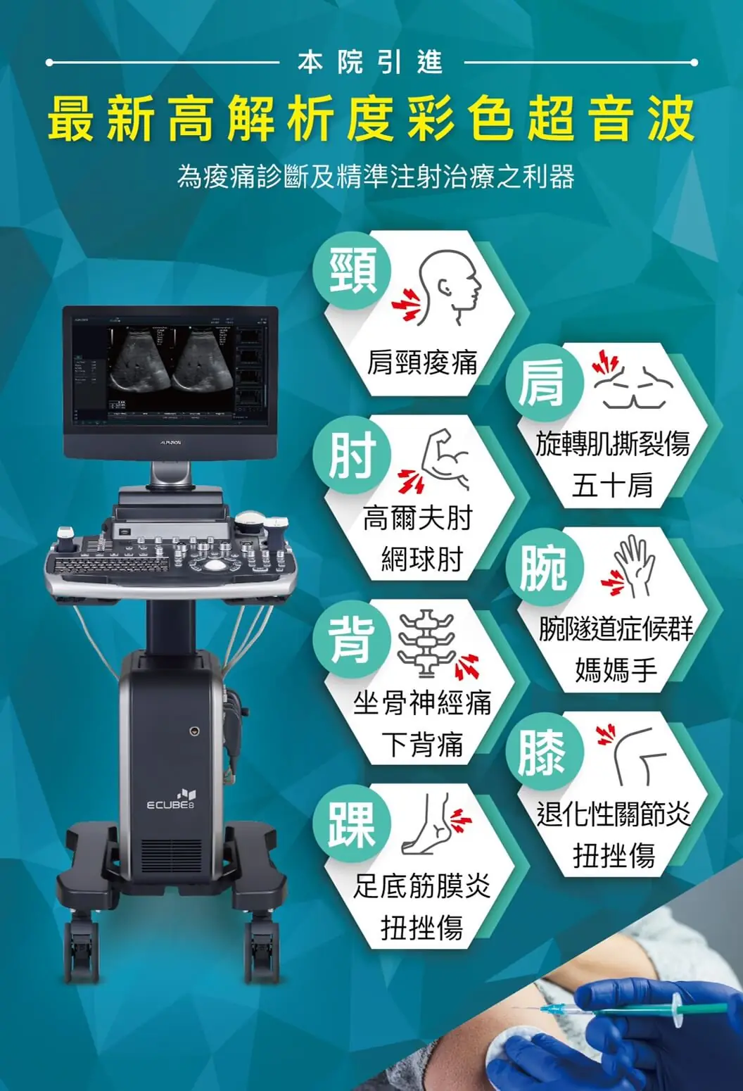 超音波檢測