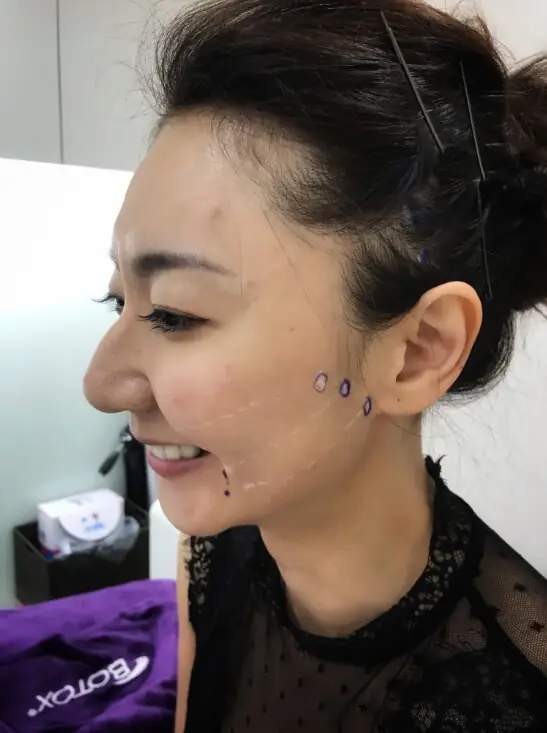 Eileen:英爵醫美讓我的年齡繼續是秘密