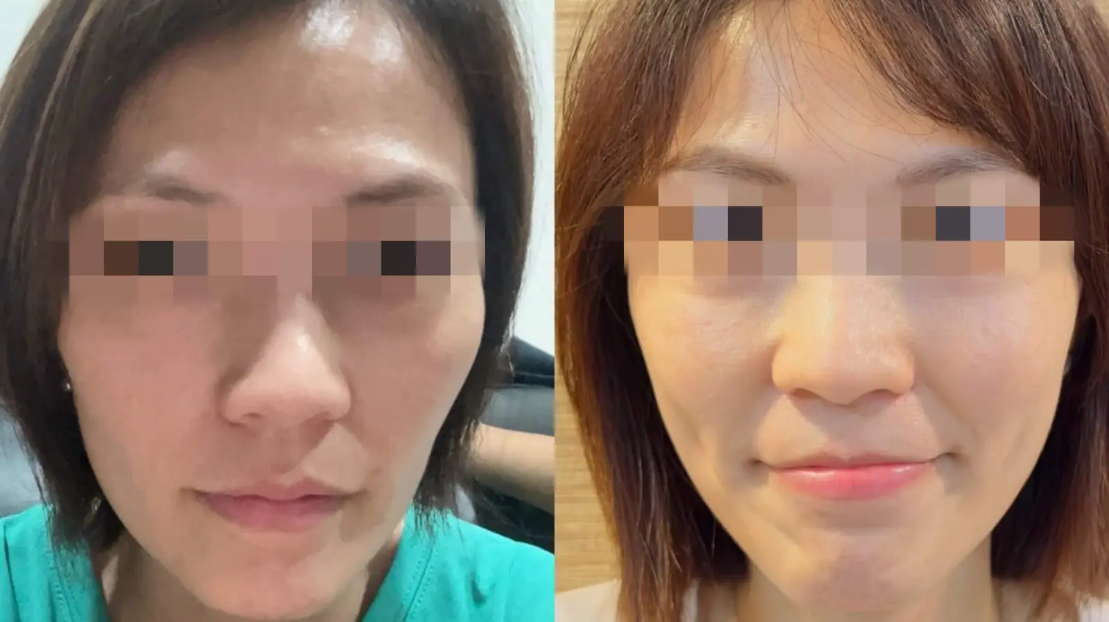 想要實現自然有效的悄悄變美， 需要一個客製化的全方位複合療程