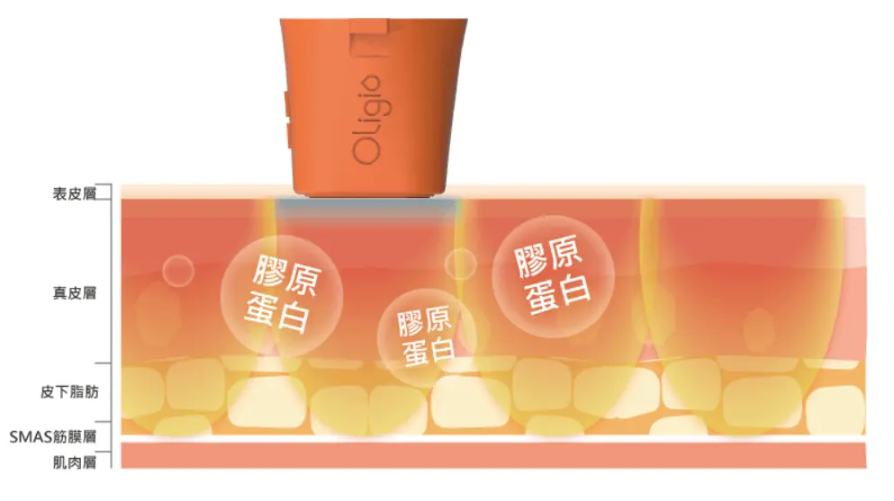 Oligio電波訂製你的專屬美