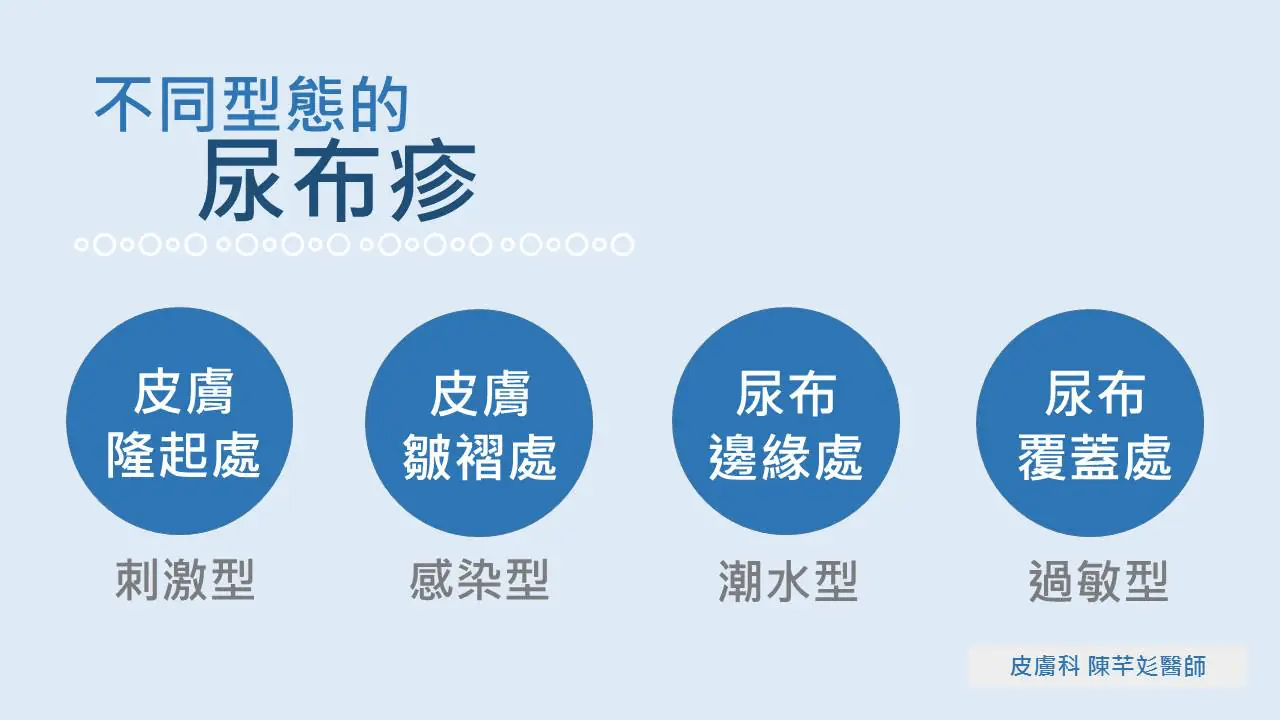 你家寶寶也有紅屁屁嗎？嬰兒最常見的皮膚問題之—尿布疹