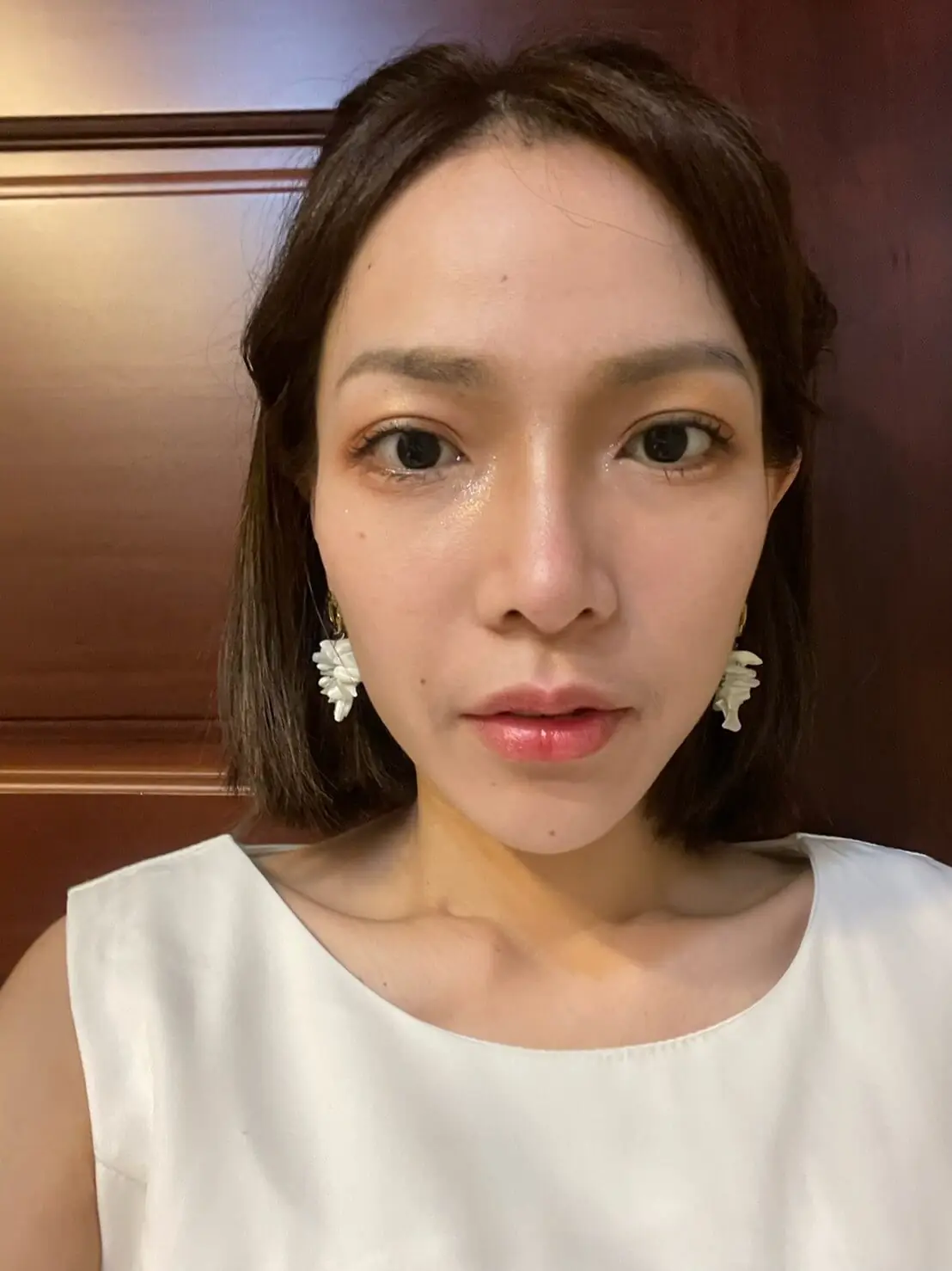 絲絲 : 法令紋+夫妻宮凹陷，打造自然澎潤好氣色，擺脫疲累感!｜玻尿酸