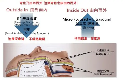 Ulthera5