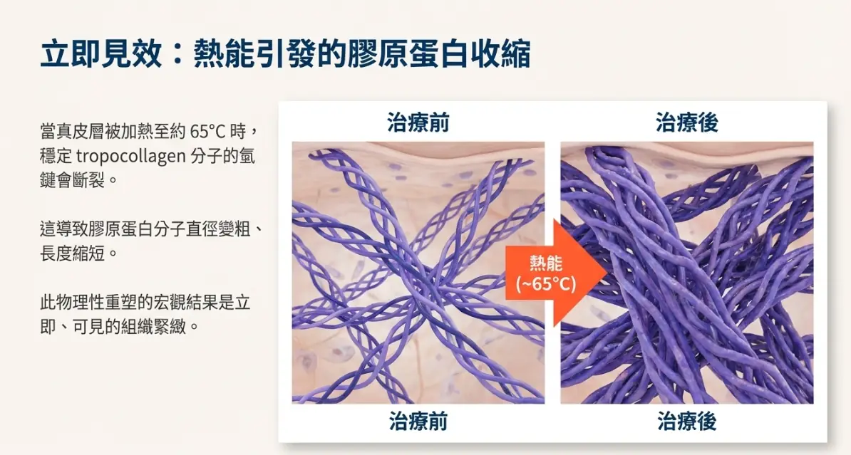不只拉提，更是延緩老化：鳳凰電波藏在皮膚底層的 4 個科學真相