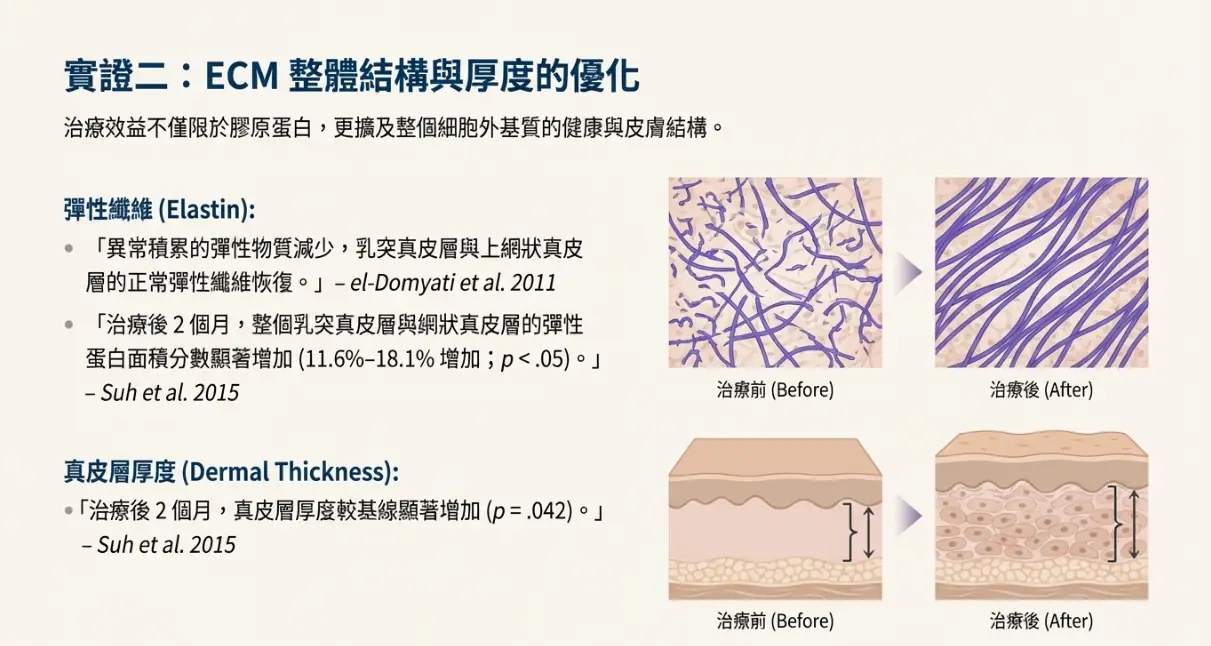 不只拉提，更是延緩老化：鳳凰電波藏在皮膚底層的 4 個科學真相