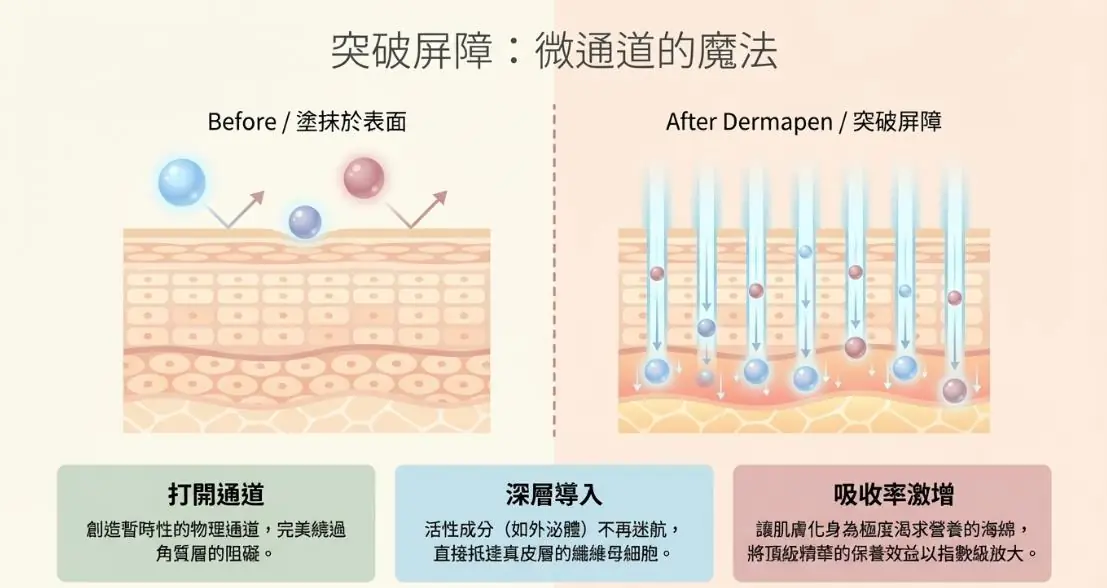 告別瑕疵，啟動肌膚再生力！Dermapen 自動微針全面解析：原理、功效與術後全攻略