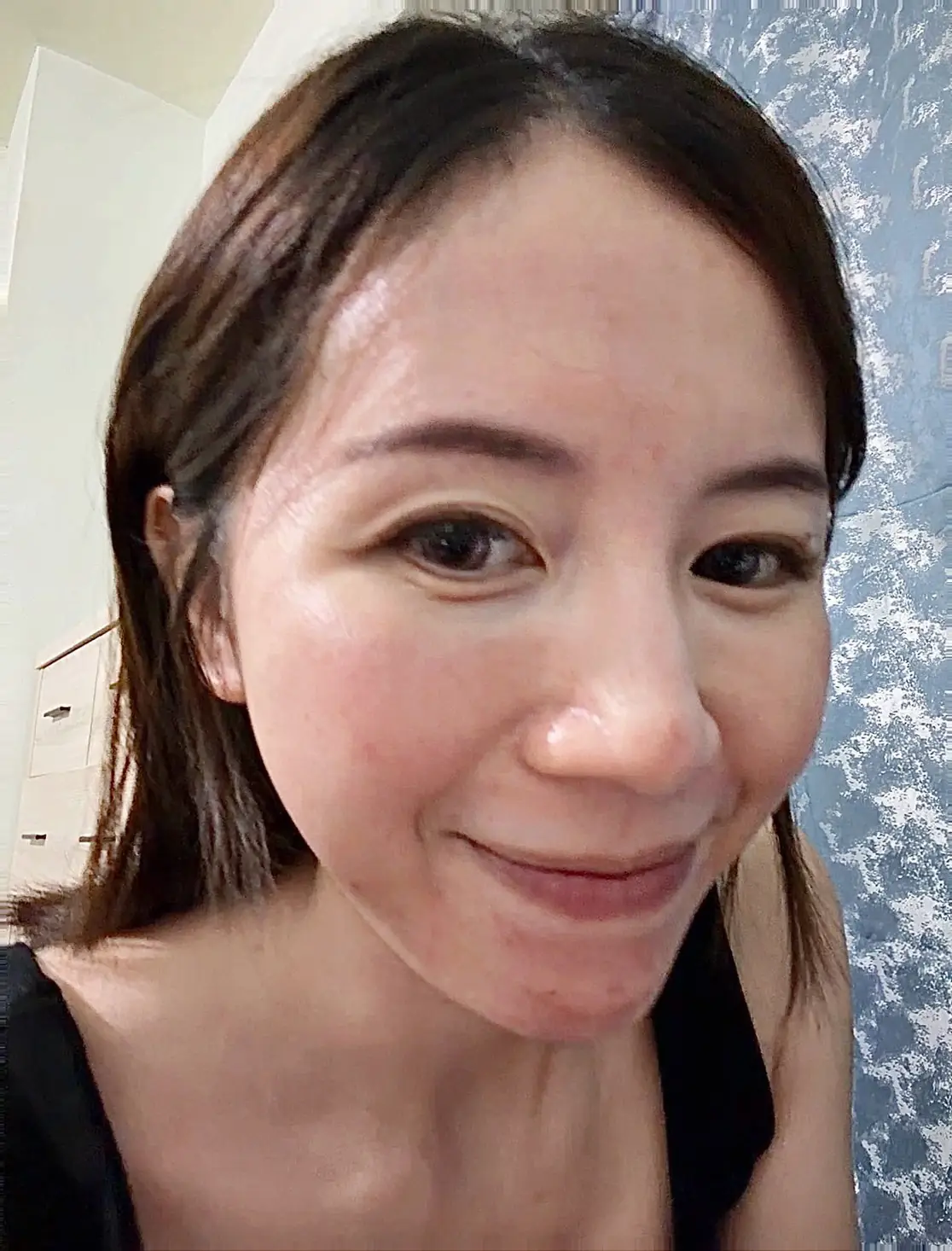 Eva：告別凹疤！素顏也擁有平滑亮感肌︱得美微針筆