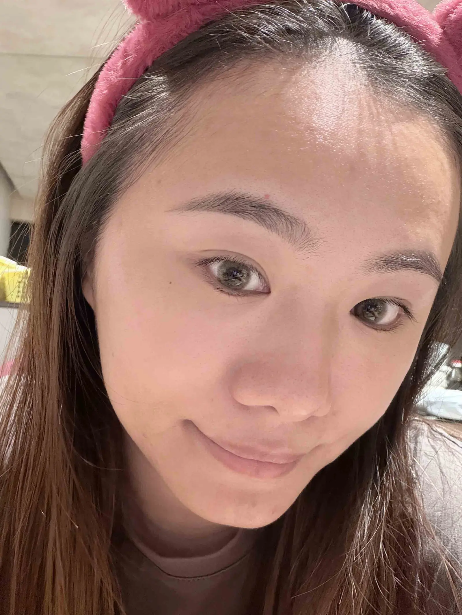 Julie : 從暗沉痘疤到無暇好膚質，找回肌膚自信光彩｜心動光