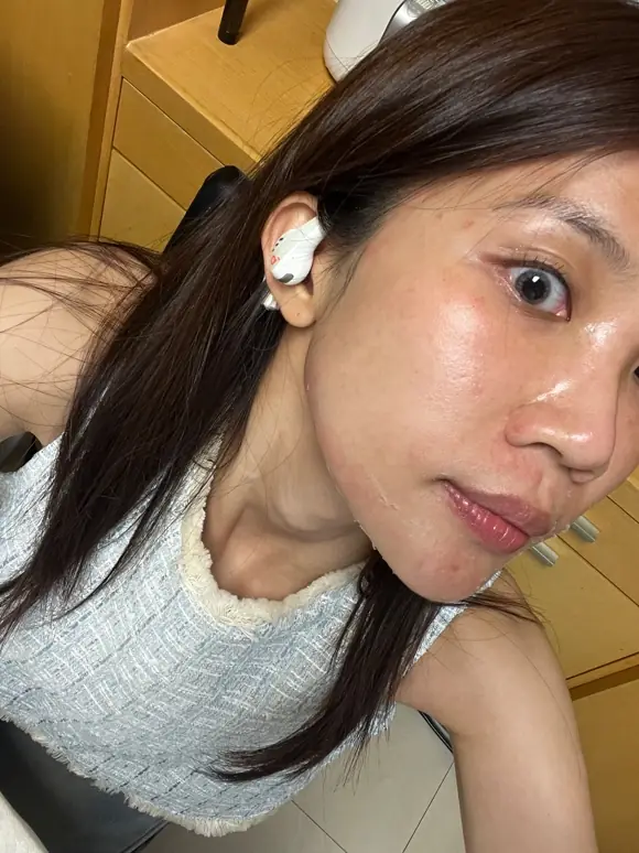 Chloe：突破保養停滯期！打造細緻勻亮好膚質︱得美微針筆