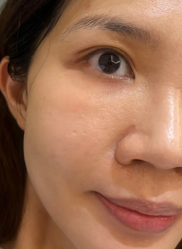 Chloe：突破保養停滯期！打造細緻勻亮好膚質︱得美微針筆