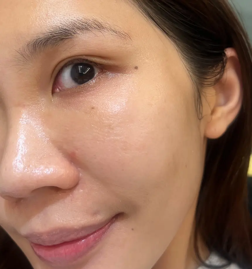 Chloe：突破保養停滯期！打造細緻勻亮好膚質︱得美微針筆