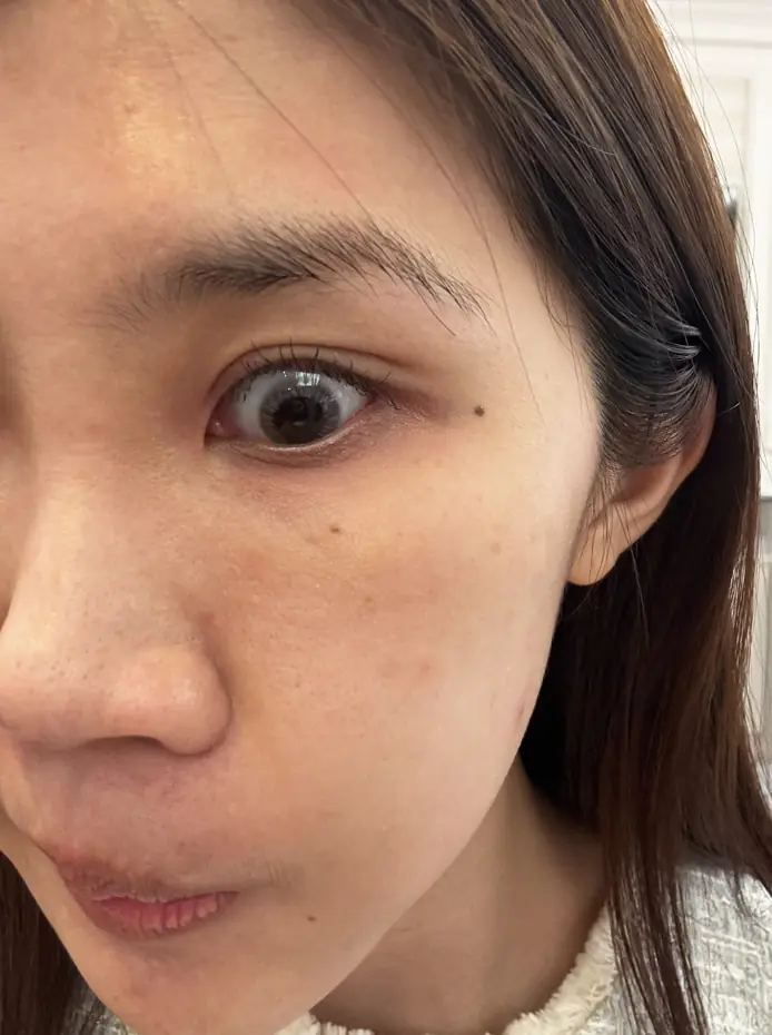 Chloe：突破保養停滯期！打造細緻勻亮好膚質︱得美微針筆